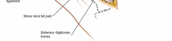 Illustration 97 for Optimized Approaches to the Dorsum of the Foot & Ankle