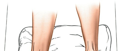 Illustration of ankle anterior approach - Dr. Mohammed Hutaif
