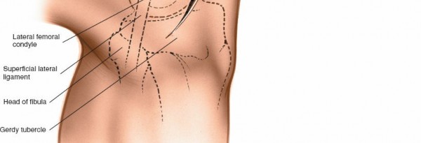 Illustration 137 for Mastering Knee Approaches: Spotlight on Superficial Medial Ligament