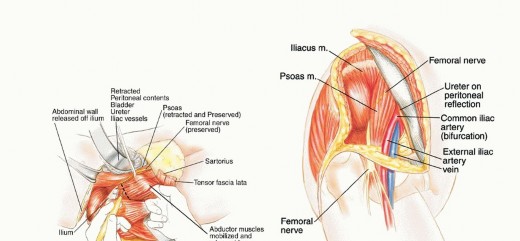 Illustration 21 for Surgical Pelvic Resection: Gluteus Maximus Muscle & Nerve Preservation