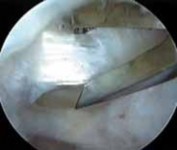 Illustration 14 for J. W. Thomas on Snapping Hip: Causes, Cures & Relief