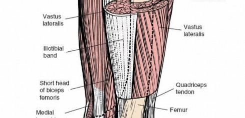 Illustration 95 for Optimal Femoral Approaches: Mastering the Lateral Intermuscular Septum