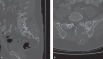 Illustration 20 for Master Orthopedic Spine Cases: Sharpen Your Diagnostic Skills