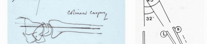 Illustration 7 for Precision Correction for Distal Radius Malunion