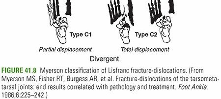 Illustration 23 for Mastering First MTP Joint & Forefoot Fractures: A Comprehensive Guide