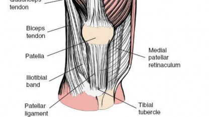 Illustration 101 for Optimal Femoral Approaches: Mastering the Lateral Intermuscular Septum