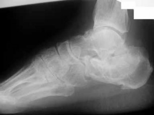 Orthopedic Foot And Ank Review | Dr Hutaif Foot & Ankle -...