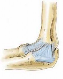 Illustration 2 for Precision Arthroscopy for Chondral Injuries & OCD: Direct Lateral Portal