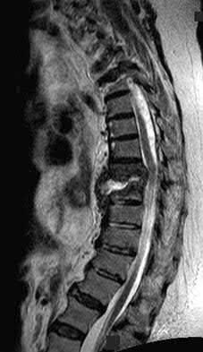 Illustration 9 for OrthoCash: Trauma MCQs & Cases for a yearold woman