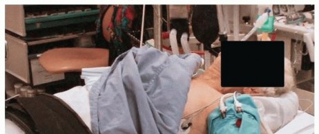 Illustration 12 for Restore Stability & Motion: Fixation of Fracture-Dislocations