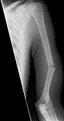 Illustration 173 for OrthoCash: Trauma MCQs & Cases for a yearold woman