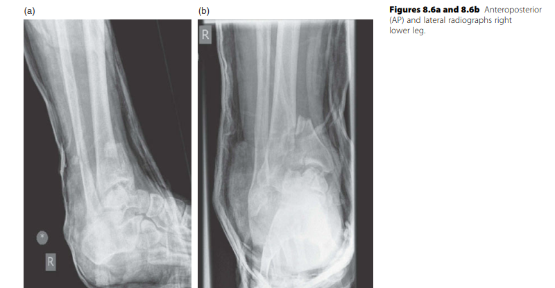 Lower Limb Trauma: Mastering This Oral Examination Question