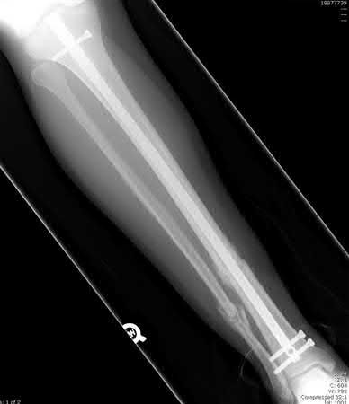 Illustration 2 for OrthoCash: Trauma MCQs & Cases for a yearold woman