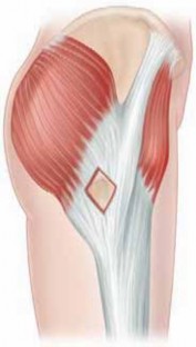 Illustration 21 for J. W. Thomas on Snapping Hip: Causes, Cures & Relief