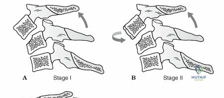 Illustration of injuries to cc - Dr. Mohammed Hutaif