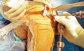 وصف طبي دقيق للمريض