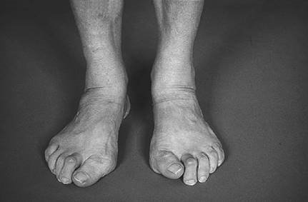 Illustration 4 for Ace FRCS Orthopaedics: Oxford University Press Adult Pathology Viva