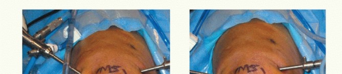 Painful Knee Swelling? Explore Synovitis of the Knee Solutions