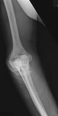 Illustration 116 for OrthoCash: Trauma MCQs & Cases for a yearold woman