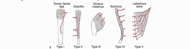 Illustration 7 for Limb-Sparing Quadriceps Resection: Superficial Femoral Artery