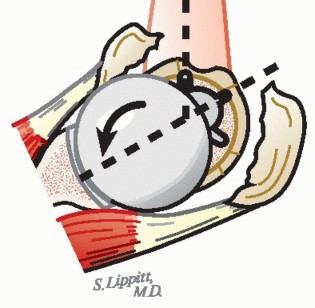 Illustration 21 for Hemiarthroplasty for Proximal: Effective Treatment for Fractures