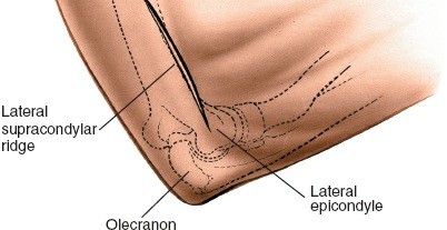 Illustration 74 for Mastering the Approach to the Distal Humerus: Safety & Skills