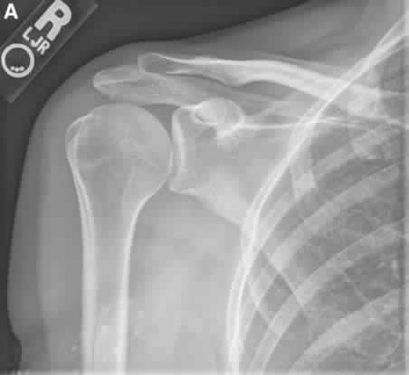 Shoulder And Elbow Orthopedic Review | Dr Hutaif Should -...