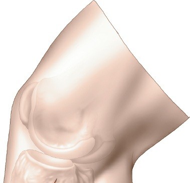 Illustration 17 for Surgical Access: Mastering the Tibia's Surface & Fibula Approaches