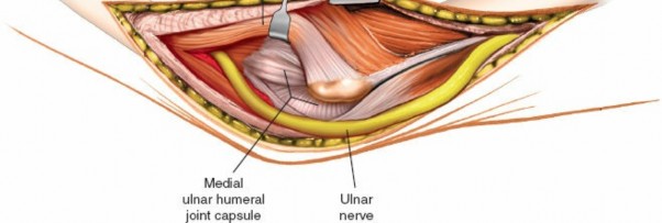 Illustration 47 for Mastering Elbow Approaches: Applied Surgical Anatomy for Precision