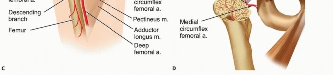 Illustration 7 for Is a Sliding Hip Screw Best for Your Femoral Neck Fracture?
