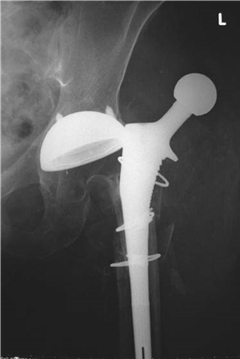 Illustration 17 for Ace FRCS Orthopaedics: Oxford University Press Adult Pathology Viva