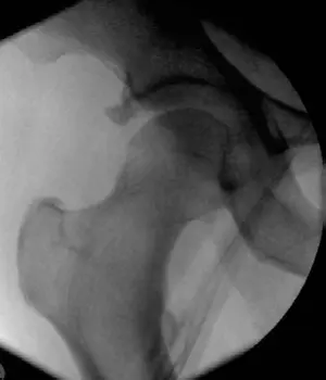 إصابات الطرف السفلي: دليل شامل للتشخيص والعلاج والتعافي مع الأستاذ الدكتور محمد هطيف