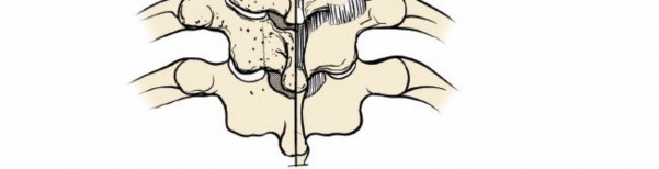 Illustration 211 for Approach to the Lumbar Spine: Mastering Techniques & Anatomy