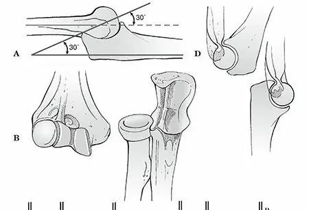 صورة توضيحية لـ خلع الكوع: دليل شامل للمرضى لاستعادة حركة ذراعك بثقة وسلامة