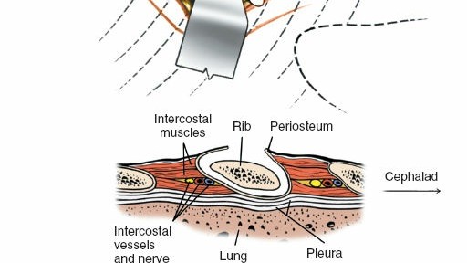 Illustration 298 for Approach to the Lumbar Spine: Mastering Techniques & Anatomy