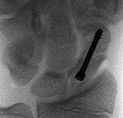 صورة طبية: دليل الأستاذ الدكتور محمد هطيف الشامل لأمراض وإصابات اليد والمعصم في صنعاء