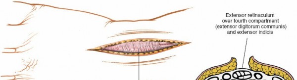 Illustration 10 for Essential Surgical Approaches: Uncover Every Aspect of the Wrist
