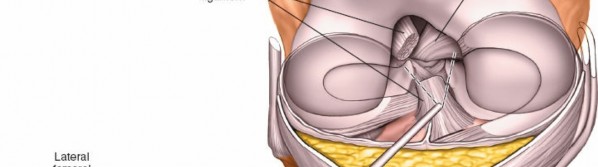 Illustration 22 for Mastering Knee Approaches: Spotlight on Superficial Medial Ligament