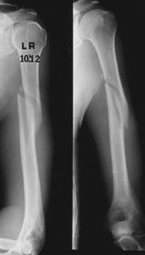 Illustration 15 for Ace Your FRCS: Key Questions in Trauma & Orthopaedics