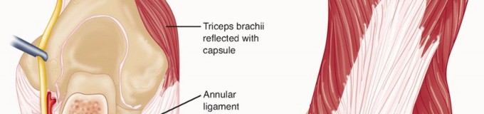 Illustration 37 for Surgical Approaches to Shoulder & Elbow: Pearls and Pitfalls