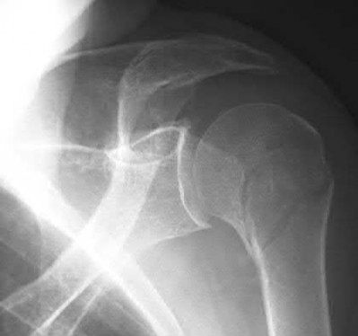 Illustration 87 for OrthoCash: Trauma MCQs & Cases for a yearold woman