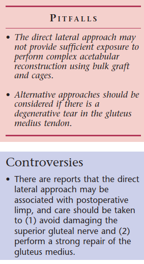 Direct Lateral Hip: Optimize Exposure with Sharp Curved Hohmann