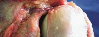 Illustration 80 for OrthoCash: Trauma MCQs & Cases for a yearold woman