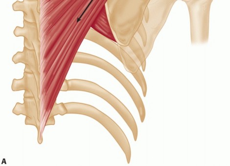 Illustration 2 for End CN XI Palsy Pain: The Eden-Lange Procedure Solution