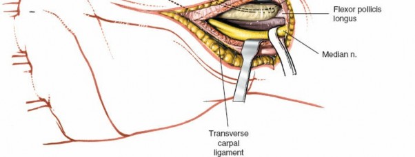Illustration 6 for Surgical Secrets: Anatomy of the Deep Palmar Space Revealed