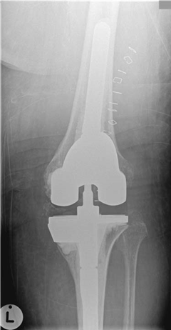Illustration 8 for Ace FRCS Orthopaedics: Oxford University Press Adult Pathology Viva