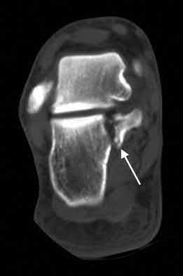 Illustration 100 for OrthoCash: Trauma MCQs & Cases for a yearold woman