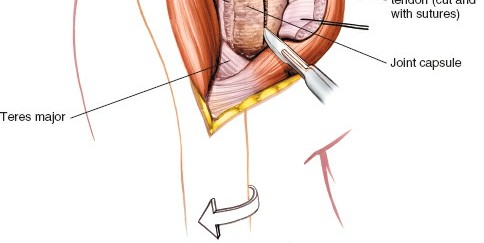 Illustration 34 for Essential Guide: Mastering Every Approach to the Shoulder