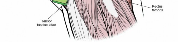 Illustration 167 for Unlocking Every Aspect of the Hip's Surgical Approaches