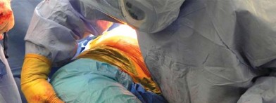 Illustration 41 for Unlock better THA: The technique of short stem for less invasiveness